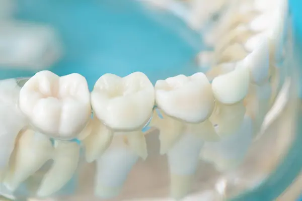 Zahnmodell Zahnmodell Konzept Der Zahnmedizin — Stockfoto