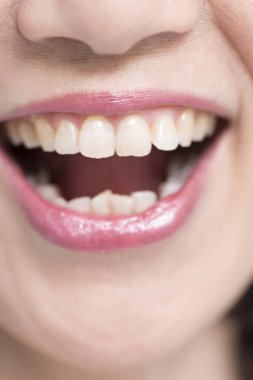 woman with opened mouth close up