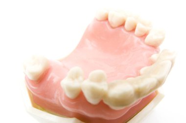 Öğrencilerin dişlerini gösteren eğitim modelini öğrenmeleri için implant ve ortodontik model