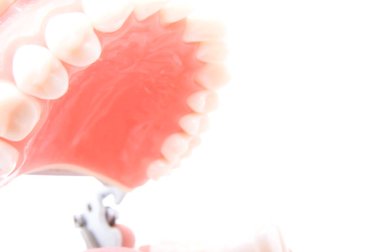 Öğrencilerin dişlerini gösteren eğitim modelini öğrenmeleri için implant ve ortodontik model