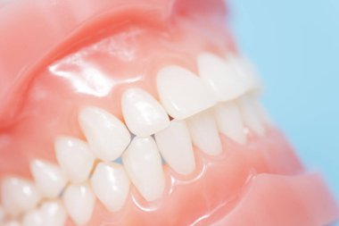 Diş modelinin yakın plan fotoğrafı. 