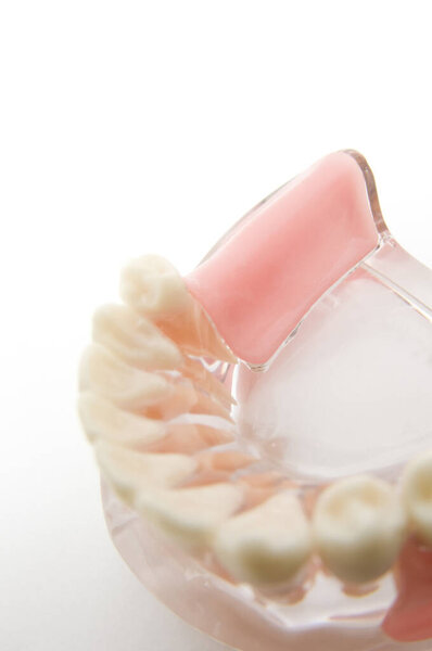 implant and orthodontic model for student to learning teaching model showing teeth