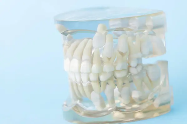Zahnmodell Zahnmodell Konzept Der Zahnmedizin — Stockfoto