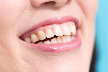close up of woman 's teeth 