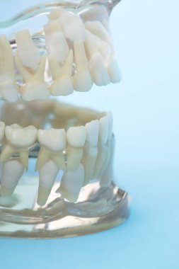 Diş modeli, diş modeli, dişçilik kavramı