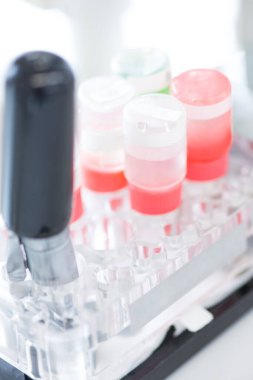 Laboratuvarda test tüpleri, yakın çekim. tıbbi araştırma 
