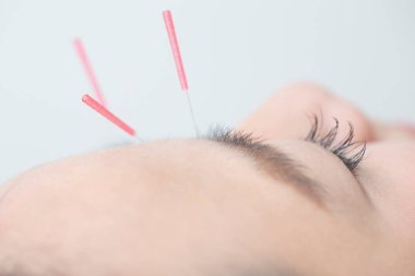 Güzel Japon Kadın Güzellik Merkezi 'nde Akupunktur Muayenesi Yapıyor