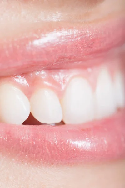 クローズ 女性の口と歯の上 — ストック写真