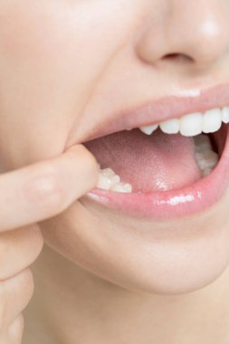 asian girl showing her teeth with her mouth pulling wide open by her finger