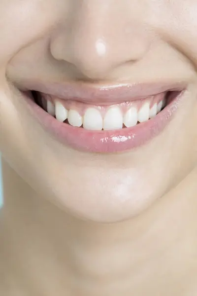 Sonriente Boca Femenina Con Dientes Blancos Dientes Sanos Higiene Dental —  Fotos de Stock