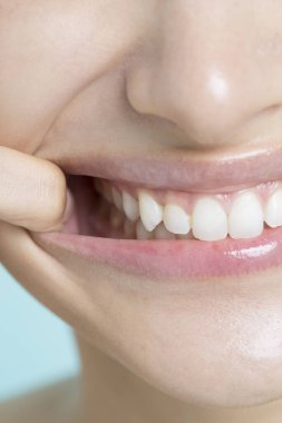 asian girl showing her teeth with her mouth pulling wide open by her finger