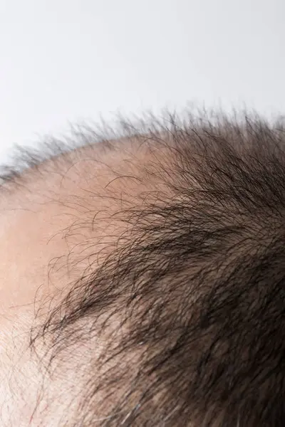 男人放松头发的主题 头发和蔼 头发光秃秃 电影制片厂拍摄的白色背景 — 图库照片