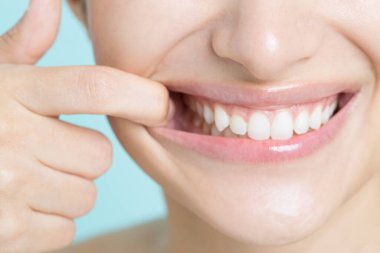 asian girl showing her teeth with her mouth pulling wide open by her finger
