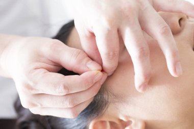 Asyalı kadın akupunktur seansında.