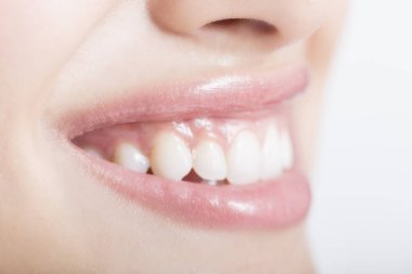 Kadın ağzı ve dişlerinin yakın çekimi..