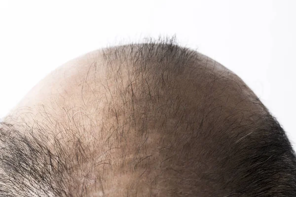 男人放松头发的主题 头发和蔼 头发光秃秃 电影制片厂拍摄的白色背景 — 图库照片