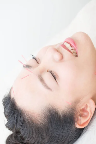 Mooi Japans Vrouw Het Krijgen Van Cupunctuur Behandeling Schoonheid Spa — Stockfoto