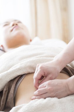 Asyalı kadın akupunktur seansında.