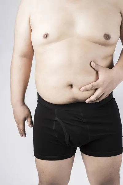 Dicker Mann Mit Dickem Bauch Übergewichtiger Mann Studioporträt — Stockfoto