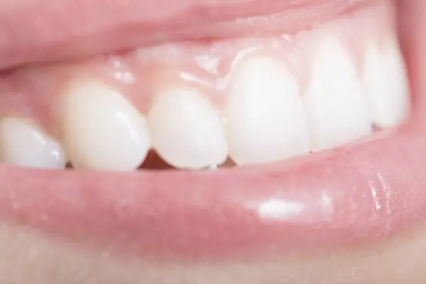 Närbild Kvinnans Mun Och Tänder — Stockfoto