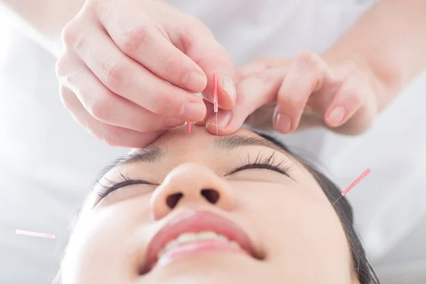 Belle Japonais Femme Obtention Acupuncture Traitement Dans Beauté Spa — Photo