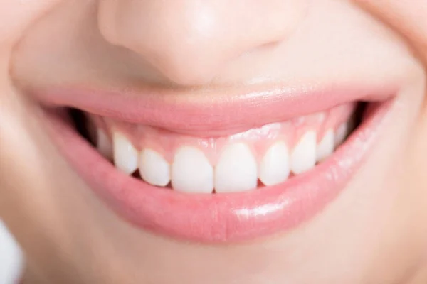 Zbliżenie Ust Zębów Kobiety — Zdjęcie stockowe