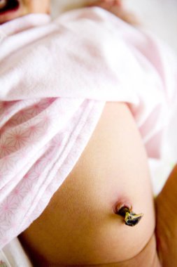 Bebeğin göbek deliğini gösteren yakın çekim