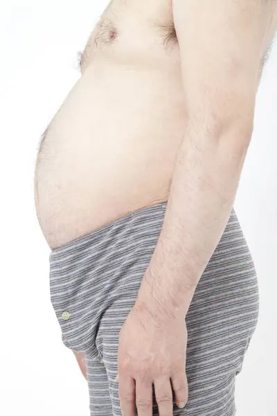Fat Man Underwear Shows Fat Deposits Abdomen Concept Proper Nutrition — Stock Photo, Image