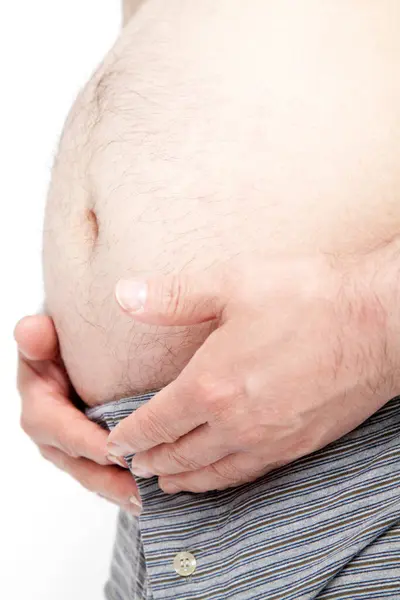 Fat Man Underwear Shows Fat Deposits Abdomen Concept Proper Nutrition — Stock Photo, Image