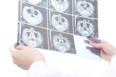 Doktor beyninin röntgen görüntüsünü gösteriyor