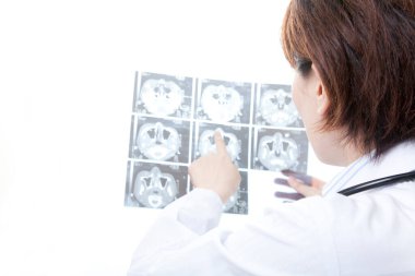 Röntgenli Asyalı kadın doktor.