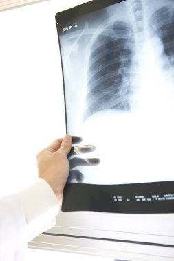 Kadın doktor röntgeni inceliyor. 