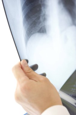 Kadın doktor röntgeni inceliyor. 