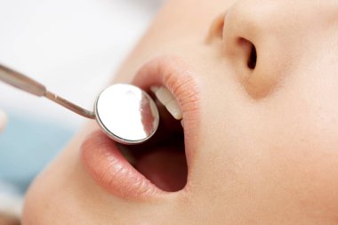 Doktor diş aynası ile hastayı muayene ediyor. 