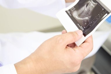 Modern bir hastanede teşhis cihazları. Yakın çekim görünümü