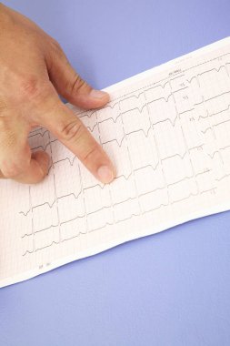 Doktor hastanede hastanın elektrokardiyogramını (EKG) kontrol ediyor..