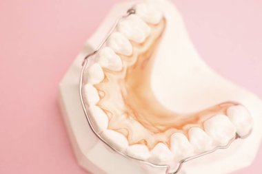 Pembe arka planda diş modeli ve metal diş teli