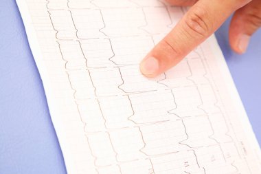Doktor hastanede hastanın elektrokardiyogramını (EKG) kontrol ediyor..