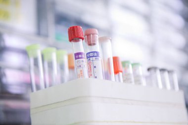 Modern laboratuvar örnekleriyle kan test tüplerinin yakın görüntüsü..         