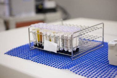 Modern laboratuvar örnekleriyle kan test tüplerinin yakın görüntüsü..         