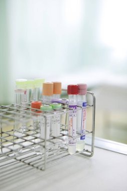 Laboratuvar ekipmanları gündüz vakti klinik çalışma alanında çeşitli test tüplerini gösteriyor.