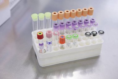 Farklı renklerde tıbbi laboratuvar test tüpleri