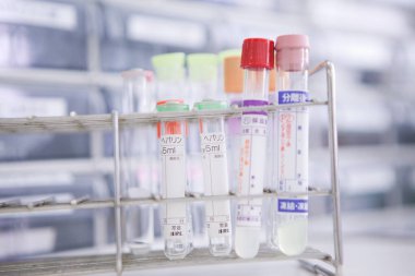 Üzerinde bir sürü test tüpü olan bir raf.