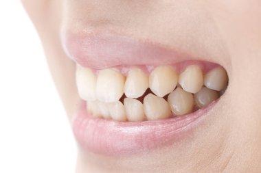 Genç kadın dişleri, yakın plan.