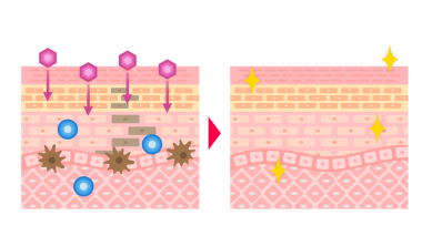 Cilt Çapraz Bölümü: Cilt Çiziminden Önce ve Sonra