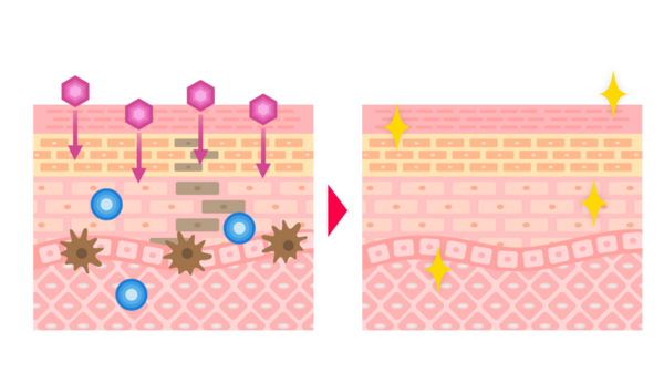 Cilt Çapraz Bölümü: Cilt Çiziminden Önce ve Sonra