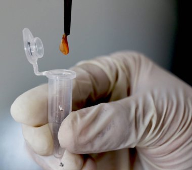 Virüs tanıma için PCR testinin farklı aktiviteleri 