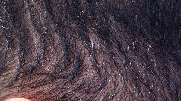 Menschliches Haar Aus Dem Meer Kurze Haare Makroaufnahme — Stockfoto