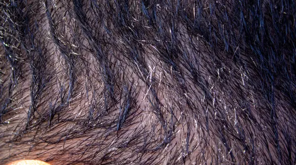 Людське Волосся Моря Коротке Волосся Макро Постріл — стокове фото