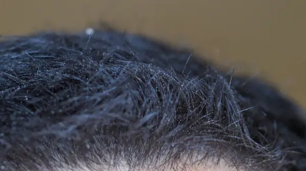 Lidské Vlasy Moře Krátké Vlasy Makro Záběr — Stock fotografie
